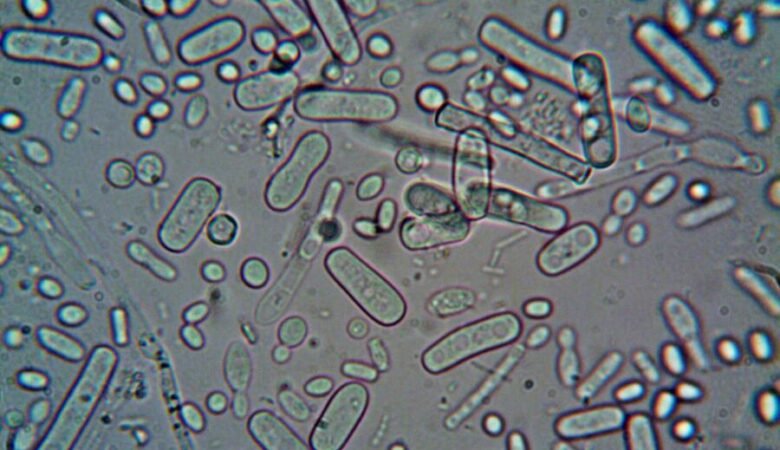 Hai un biofilm vescicale? Fai il test!